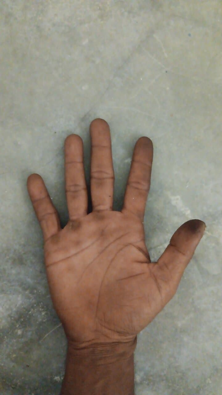 Lord Lugard's Residence and Iron of Liberty